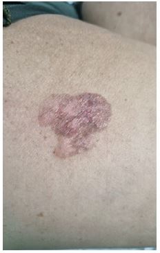  &nbsp;&nbsp;Images are Not Display Check it 